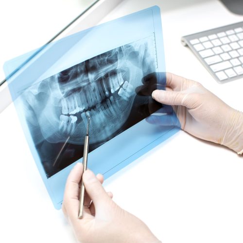 protesis-dental-maiquez (12)