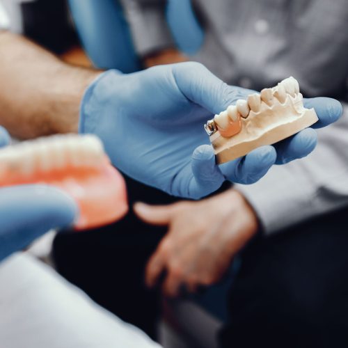 protesis-dental-maiquez (6)