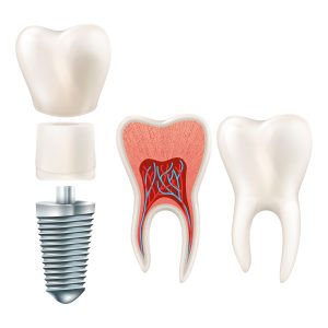 protesis-dental-maiquez (9)